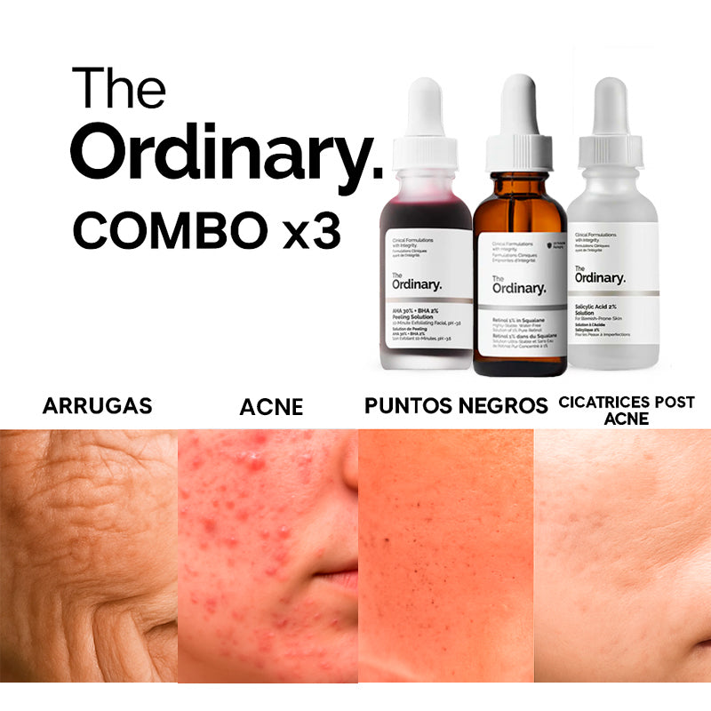 Combo The Ordinary | Anti Acné: Peeling + Retinol + Ácido Salicílico