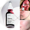 Peeling Solution AHA 30% + BHA 2% The Ordinary - Piel renovada