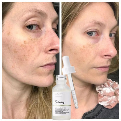 The Ordinary Niacinamida 10% + Zinc 1% (30 ml)