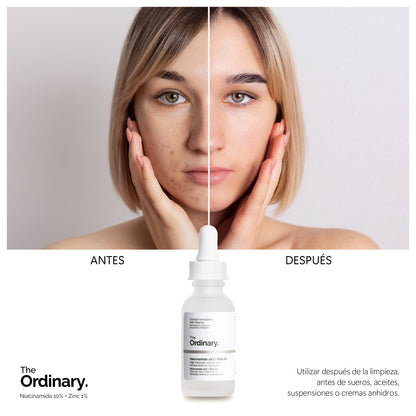 The Ordinary Niacinamida 10% + Zinc 1% (30 ml)