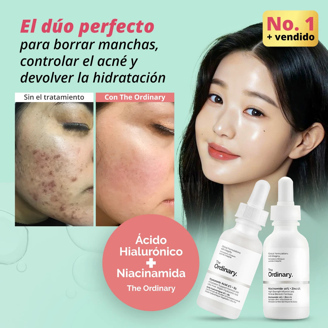 Niacinamida + Acido Hialuronico: Combo Anti-Manchas y Anti-Acné + Hidratación Profunda