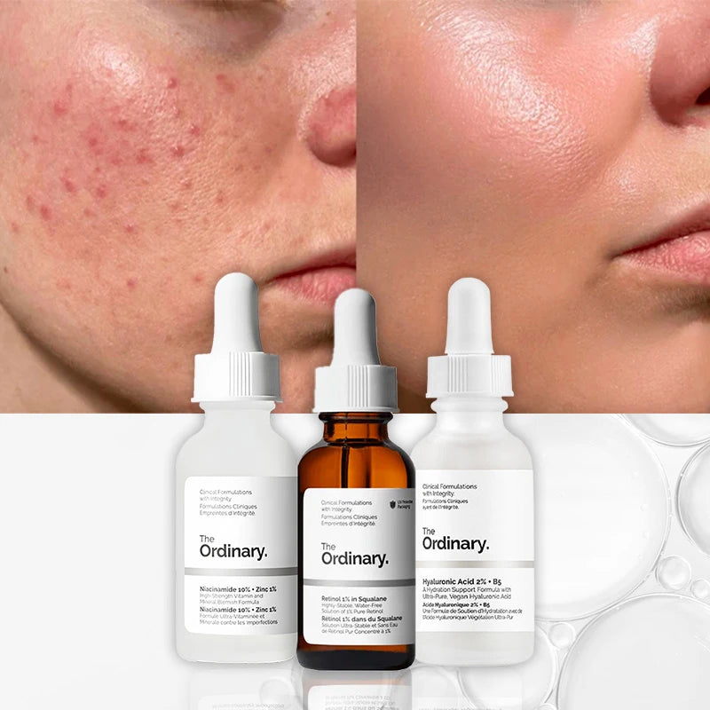Combo Anti-Poros + Glow + Renovación | Niacinamida + Ácido Hialurónico + Retinol