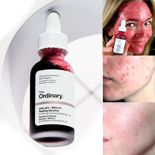 Peeling Solution AHA 30% + BHA 2% The Ordinary - Piel renovada