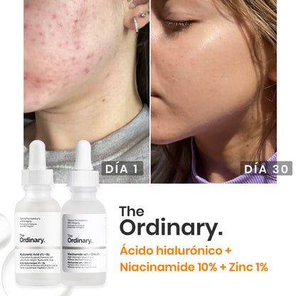 Niacinamida + Acido Hialuronico: Combo Anti-Manchas y Anti-Acné + Hidratación Profunda