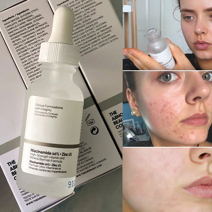 The Ordinary Niacinamida 10% + Zinc 1% (30 ml)
